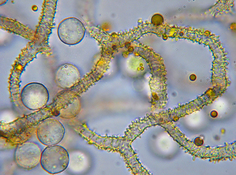 Arcyria (pomiformis ?)